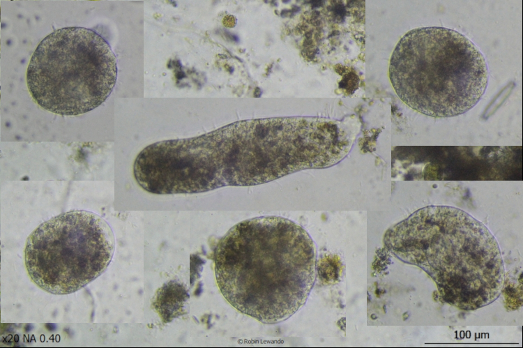 Fig 3 - A selection of Pelomyxa amoebae